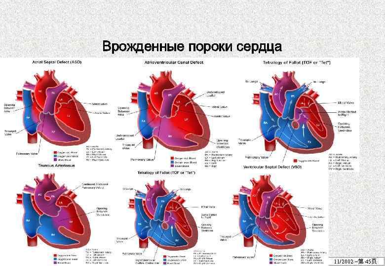 Врожденные пороки сердца 11/2002 –第 45页 