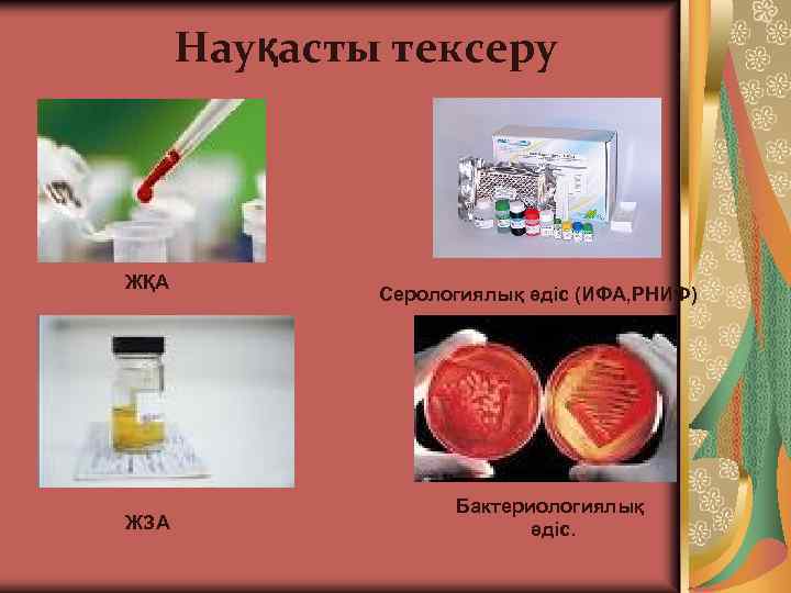 Науқасты тексеру ЖҚА ЖЗА Серологиялық әдіс (ИФА, РНИФ) Бактериологиялық әдіс. 