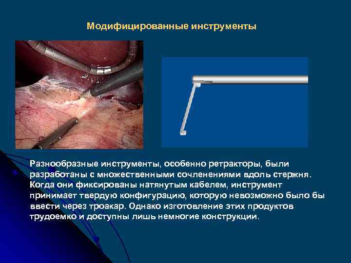 Модифицированные инструменты Разнообразные инструменты, особенно ретракторы, были разработаны с множественными сочленениями вдоль стержня. Когда