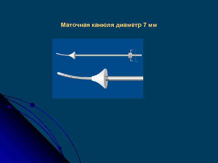 Маточная канюля диаметр 7 мм 