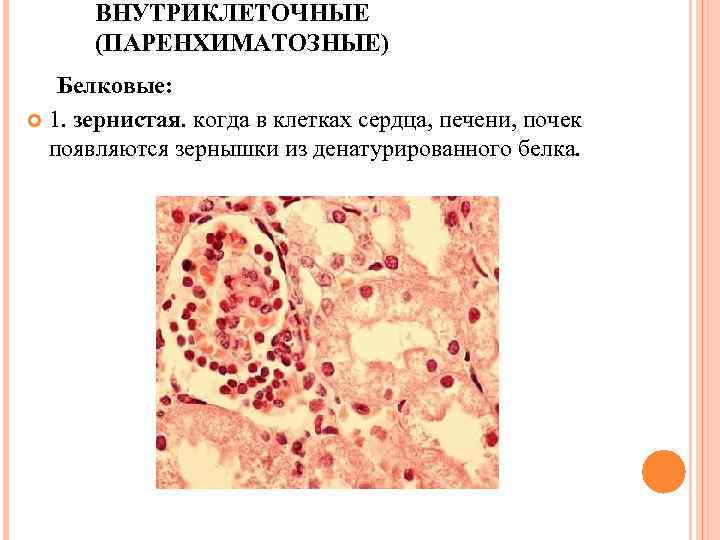 Опухоль с преобладанием паренхиматозной ткани на ощупь