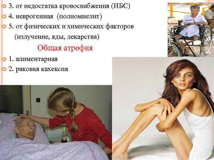 3. от недостатка кровоснабжения (ИБС) 4. неврогенная (полиомиелит) 5. от физических и химических факторов