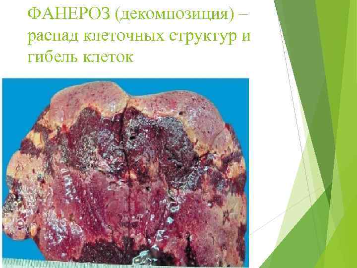 ФАНЕРОЗ (декомпозиция) – распад клеточных структур и гибель клеток 