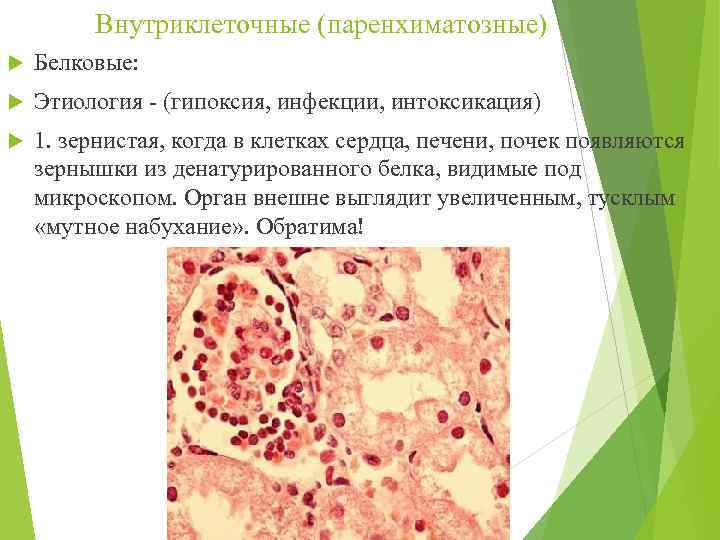Внутриклеточные (паренхиматозные) Белковые: Этиология - (гипоксия, инфекции, интоксикация) 1. зернистая, когда в клетках сердца,