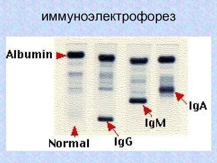 иммуноэлектрофорез 