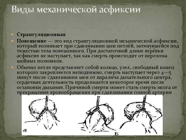 Виды механической асфиксии Странгуляционная Повешение — это вид странгуляционной механической асфиксии, который возникает при