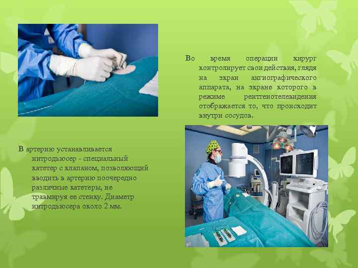 Во В артерию устанавливается интродьюсер - специальный катетер с клапаном, позволяющий вводить в артерию