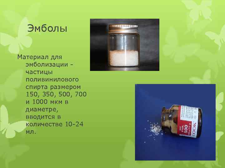 Эмболы Материал для эмболизации - частицы поливинилового спирта размером 150, 350, 500, 700 и