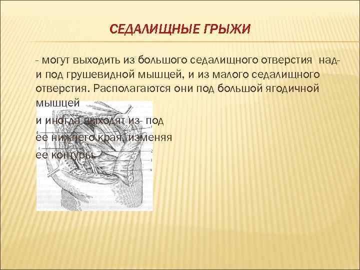 СЕДАЛИЩНЫЕ ГРЫЖИ - могут выходить из большого седалищного отверстия нади под грушевидной мышцей, и