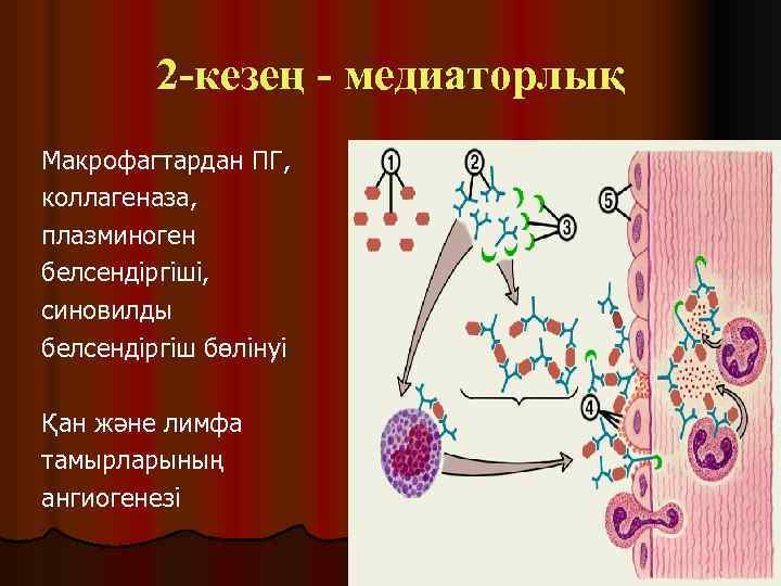 2 -кезең - медиаторлық Макрофагтардан ПГ, коллагеназа, плазминоген белсендіргіші, синовилды белсендіргіш бөлінуі Қан және