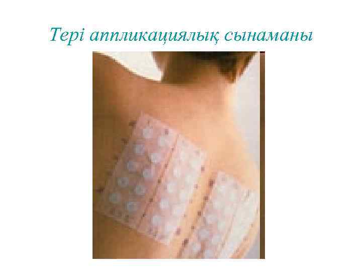 Тері аппликациялық сынаманы 