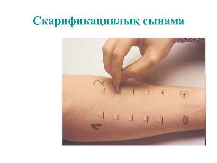 Скарификациялық сынама 