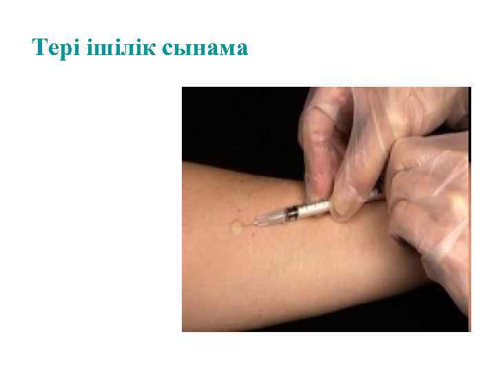 Тері ішілік сынама 