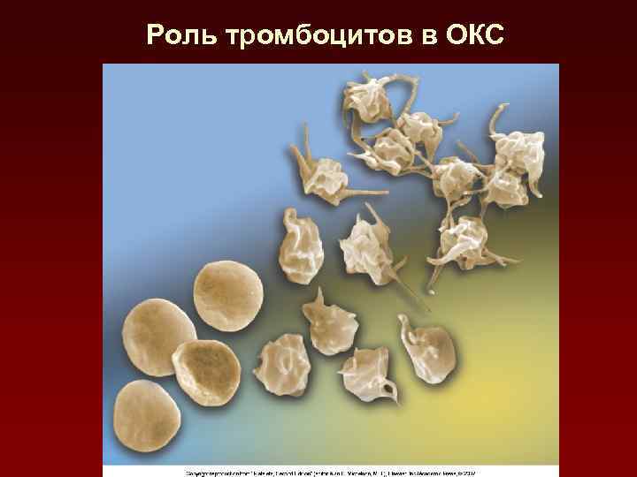 Роль тромбоцитов в ОКС 