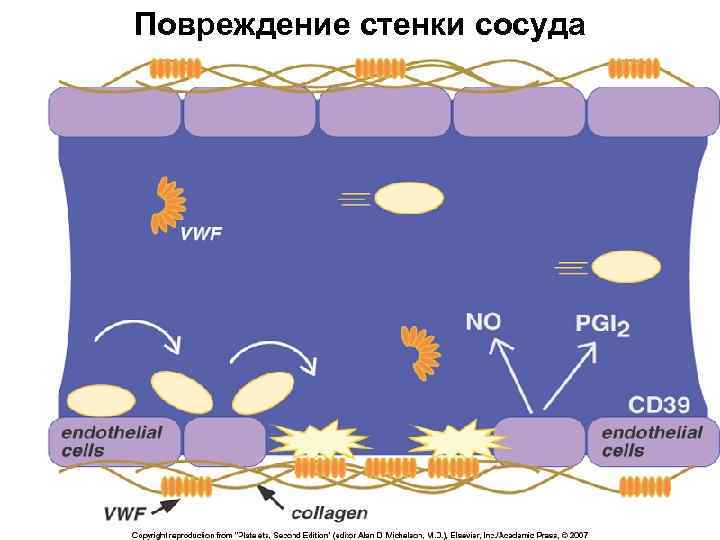 Повреждение стенки сосуда 