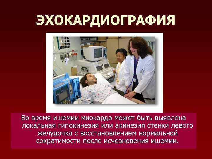 ЭХОКАРДИОГРАФИЯ Во время ишемии миокарда может быть выявлена локальная гипокинезия или акинезия стенки левого