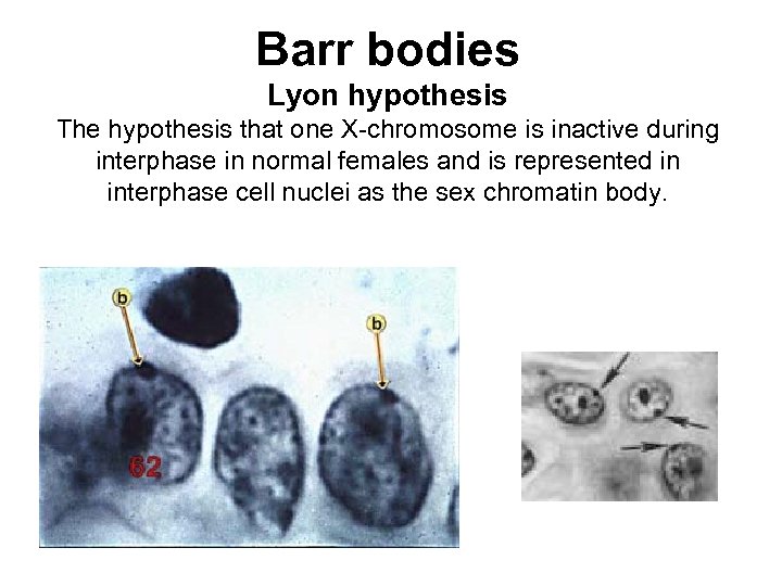 Barr bodies Lyon hypothesis The hypothesis that one X-chromosome is inactive during interphase in