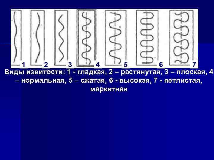 1 2 3 4 5 6 7 Виды извитости: 1 гладкая, 2 – растянутая,