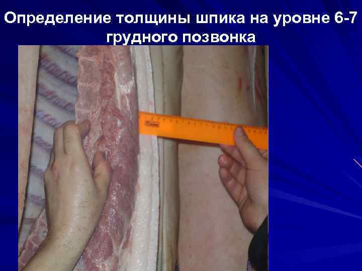 Определение толщины шпика на уровне 6 -7 грудного позвонка 
