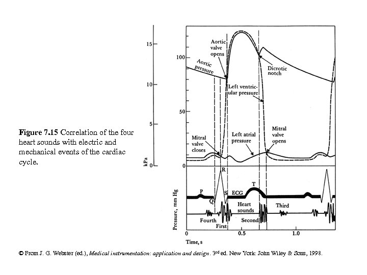 Figure 7. 15 Correlation of the four heart sounds with electric and mechanical events