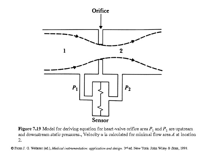 Figure 7. 19 Model for deriving equation for heart-valve orifice area P 1 and