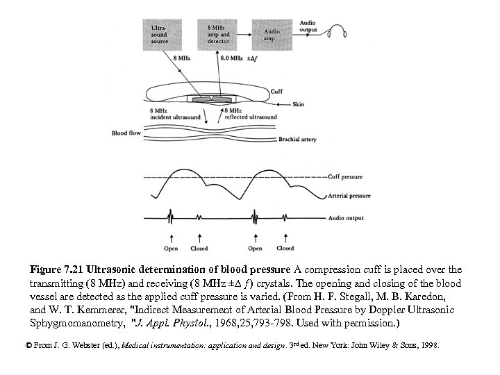 Figure 7. 21 Ultrasonic determination of blood pressure A compression cuff is placed over