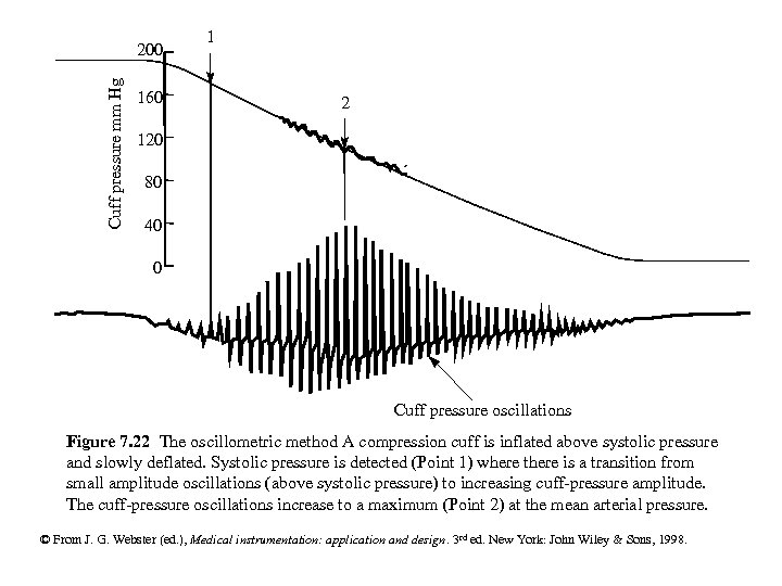 Cuff pressure mm Hg 200 160 1 2 120 80 40 0 Cuff pressure