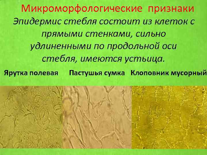 Микроморфологические признаки Эпидермис стебля состоит из клеток с прямыми стенками, сильно удлиненными по продольной