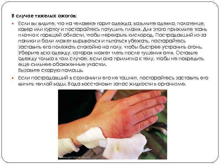 В случае тяжелых ожогов: Если вы видите, что на человеке горит одежда, возьмите одеяло,