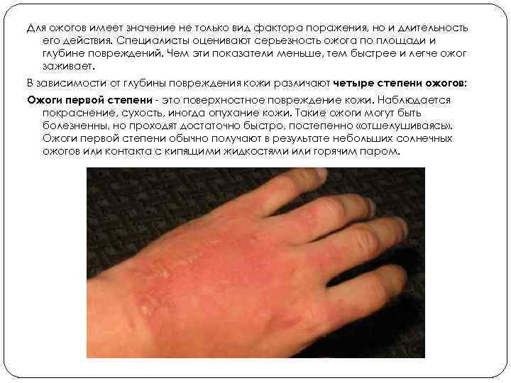 Для ожогов имеет значение не только вид фактора поражения, но и длительность его действия.