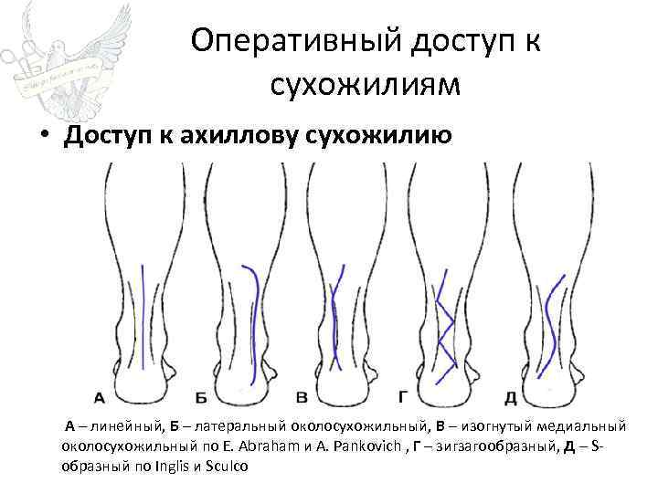 Ахиллово сухожилие фото где