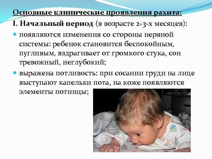 Основные клинические проявления рахита: I. Начальный период (в возрасте 2 3 х месяцев): появляются