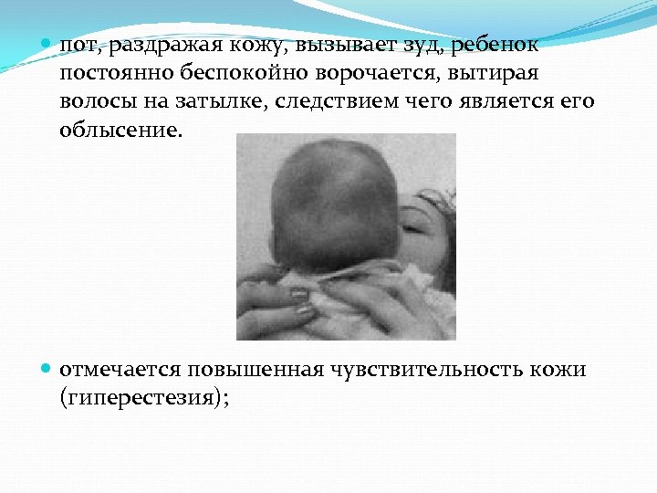 пот, раздражая кожу, вызывает зуд, ребенок постоянно беспокойно ворочается, вытирая волосы на затылке,