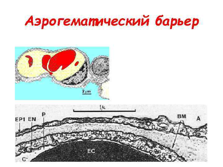 Аэрогематический барьер презентация