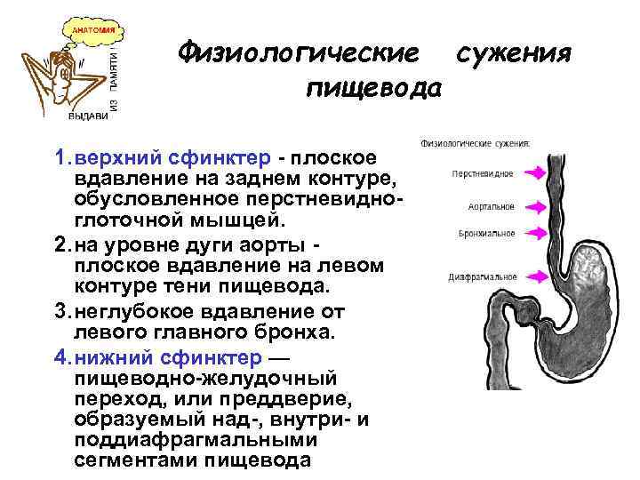 Физиологические сужения пищевода 1. верхний сфинктер - плоское вдавление на заднем контуре, обусловленное перстневидноглоточной
