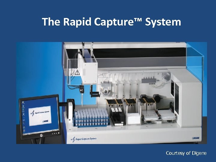 The Rapid Capture™ System Courtesy of Digene 