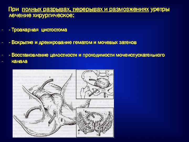 Несостоятельность цистостомы карта вызова