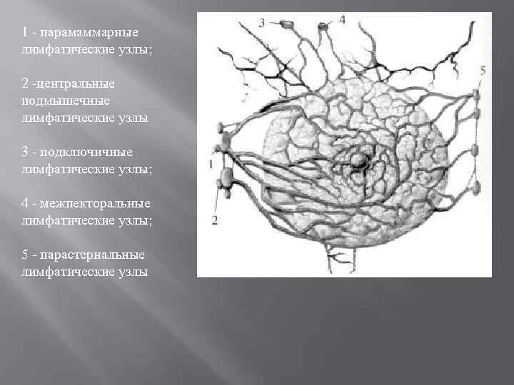 1 - парамаммарные лимфатические узлы; 2 -центральные подмышечные лимфатические узлы 3 - подключичные лимфатические