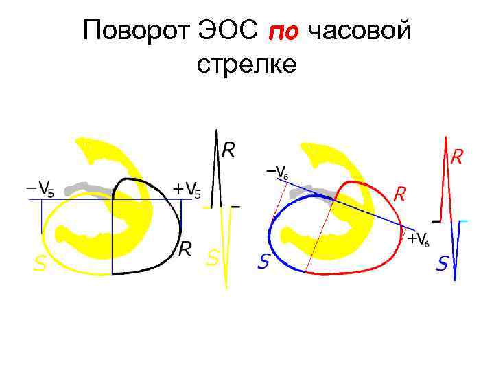 Поворот ЭОС по часовой стрелке 