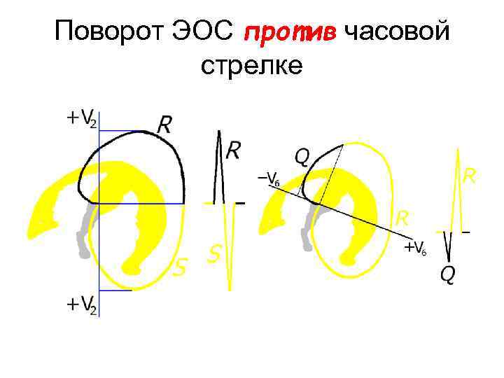 Поворот ЭОС против часовой стрелке 