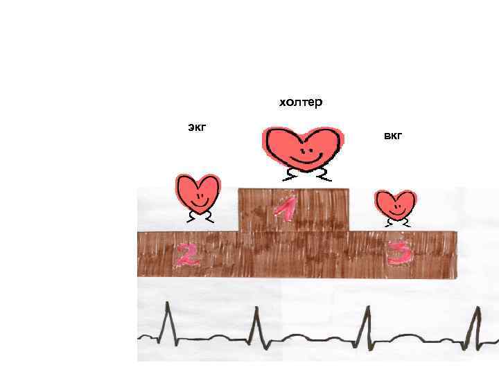 холтер экг вкг 