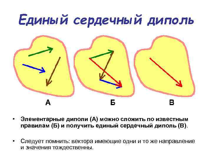 Единый сердечный диполь • Элементарные диполи (А) можно сложить по известным правилам (Б) и
