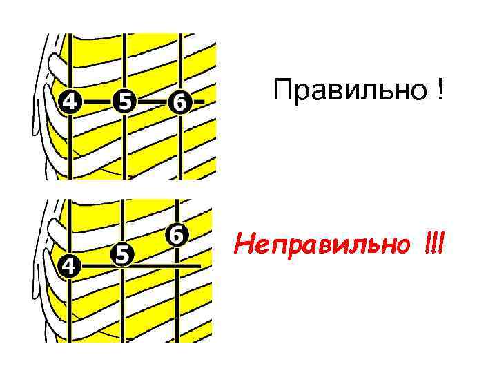 Правильно ! Неправильно !!! 