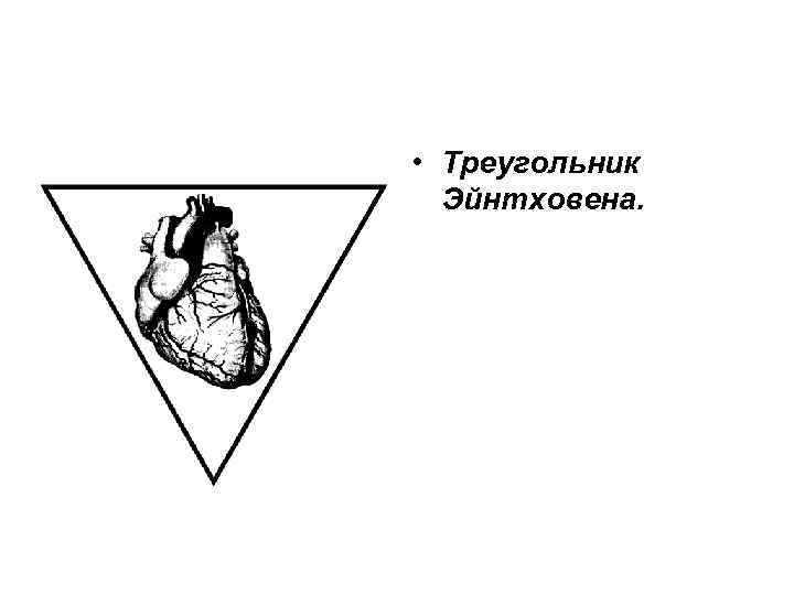  • Треугольник Эйнтховена. 