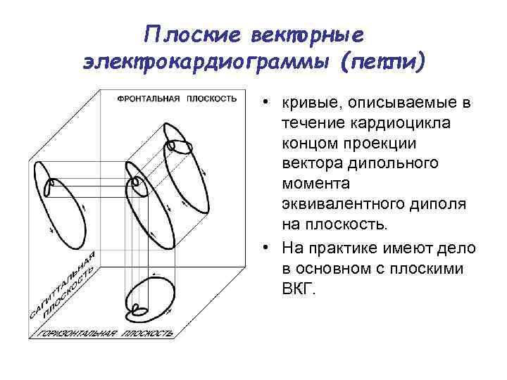 Плоские векторные электрокардиограммы (петли) • кривые, описываемые в течение кардиоцикла концом проекции вектора дипольного