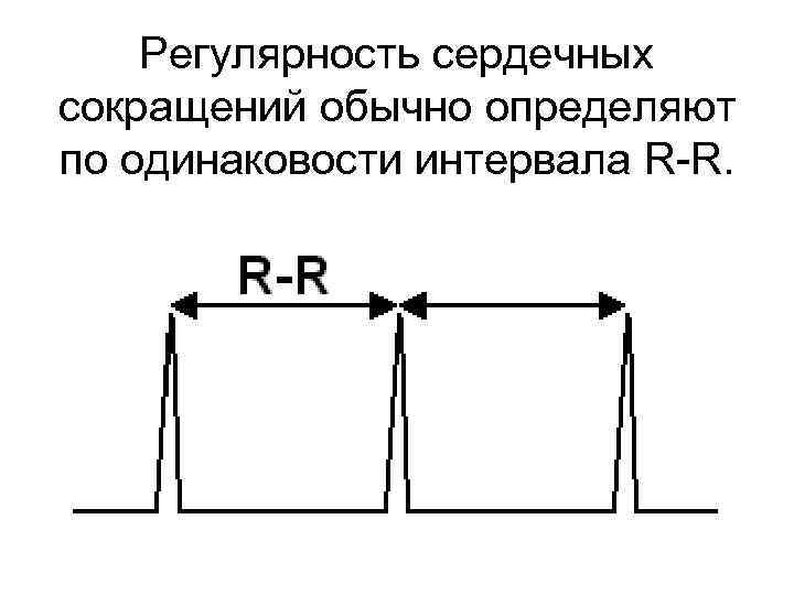Регулярность сердечных сокращений обычно определяют по одинаковости интервала R R. 