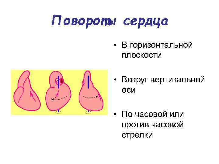 Поворот сердца