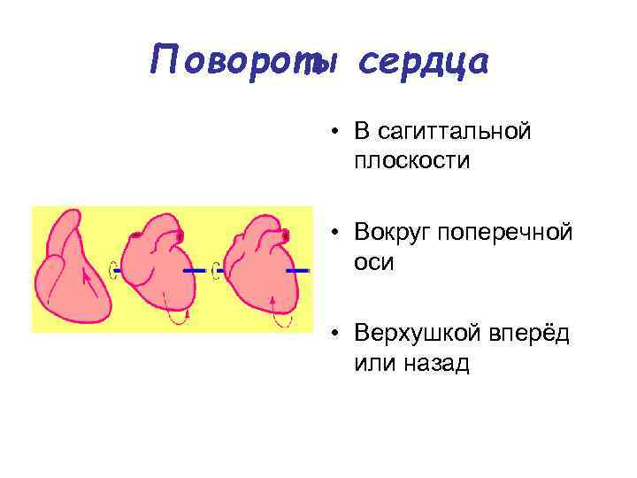 Поворот сердца