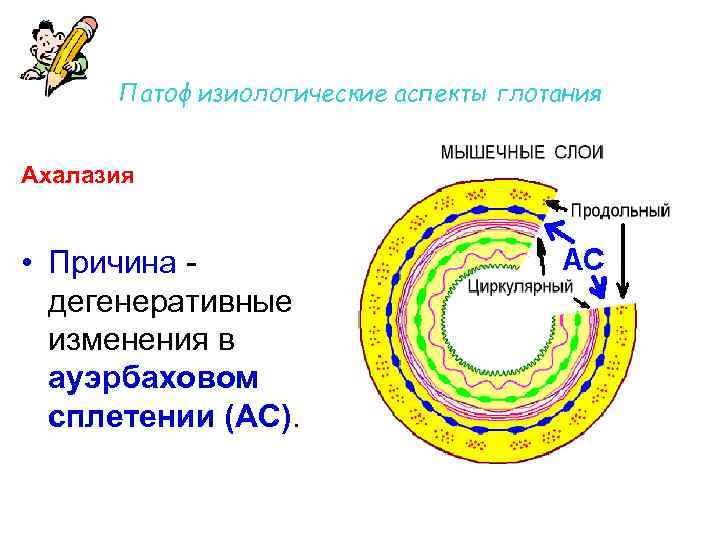 Патофизиологические аспекты глотания Ахалазия • Причина - дегенеративные изменения в ауэрбаховом сплетении (АС). 