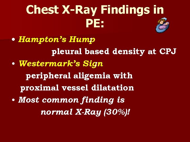 Chest X-Ray Findings in PE: • Hampton’s Hump : pleural based density at CPJ